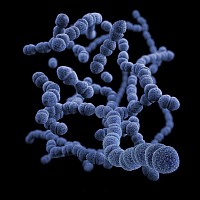 Small intestinal bacterial overgrowth, SIBO